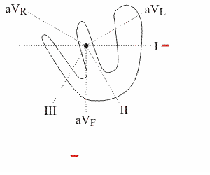 animated generation of QRS complex