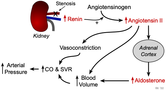 Renovascular hypertension