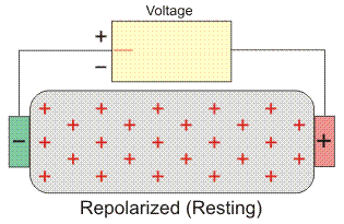 electrocardiogram recording 2