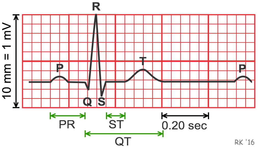 electrocardiogram durations and intervals